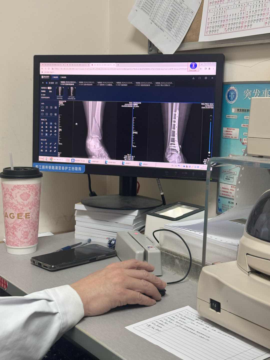 去年没上网摔跤住院,今天康复中心才回来,希望今年好运爆盆。